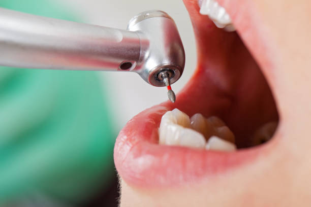 Best Emergency Treatment for Toothache in Machias, WA